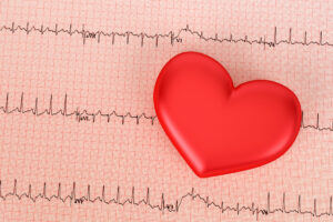 what a cardiac stress test reveals